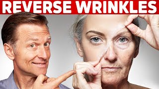 How To Reverse Wrinkles  – DrBerg on Anti Aging Hormones [upl. by Miguel]