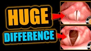 Singing amp Rapping Basics How Do Vocal Cords Work [upl. by Ker676]