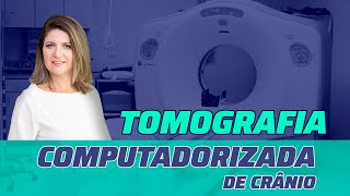 TOMOGRAFIA COMPUTADORIZADA DE CRÂNIO PASSO A PASSO [upl. by Ydennek]