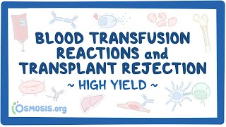 Blood transfusion reactions and transplant rejection Pathology Review [upl. by Koller]