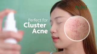 Spray away acne with Acnes ClearUp Mist [upl. by Adnot]