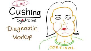 Sjogrens syndrome Usmle  Etiology  Clinical features  Diagnosis  Treatment [upl. by Sidra]