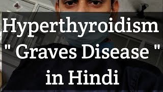 Hyperthyroidism quotGraves Diseasequot In Hindi Language  😊😊 [upl. by Aliab]