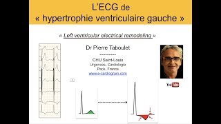 LOS expliqué en 3 minutes [upl. by Franklyn5]