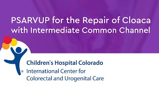 Repair of Cloaca with Intermediate Common Channel PSARVUP [upl. by Tristram]