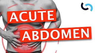 Acute Abdomen  Diagnosis and Management [upl. by Lentha310]