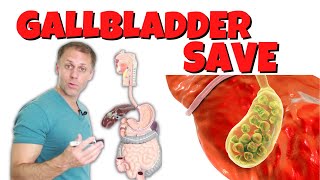 How to Save a Gallbladder and Get Rid of Gallstones [upl. by Hadeehsar793]