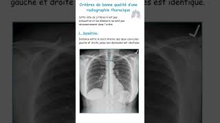 Critères De Bonne Qualité Dune Radiographie ThoraciquePneumologie shorts [upl. by Heyward]