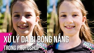 Xử Lý Da Bị Bóng Nắng Trong Photoshop  Thùy Uyên [upl. by Brenton]