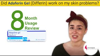 Adaferin Gel Differin 8 Months Use Review [upl. by Assirt]