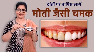 पीले दांतों सफ़ेद करने का अनोखा तरीक़ा आजतक नहीं देखा होगा  Teeth Cleaning in only 5 Minutes [upl. by Hsetim]