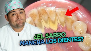 ¿¿¿EL SARRO MANCHA LOS DIENTES [upl. by Jacquelyn]