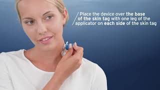 EXCILOR SKIN TAG iINSTRUCTION MOVIE [upl. by Durst]