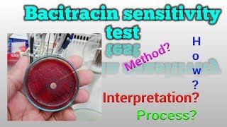 Bacitracin Sensitivity Test Microbiology [upl. by Ellecrag]