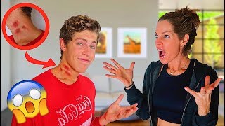 HICKEY PRANK ON MOM bad idea [upl. by Cleaves73]