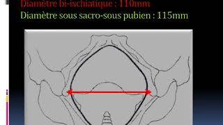 GYNECOLOGIE Examen du bassin obstetricalmp4 [upl. by Arim88]