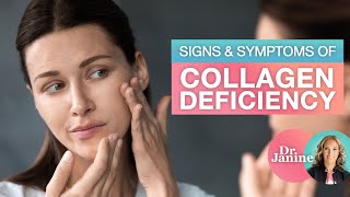 Collagen  Signs amp Symptoms of Collagen Deficiency  Dr J9 Live [upl. by Croteau]