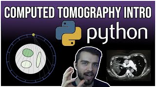 CT Scans and Tomographic Recon in PYTHON [upl. by Luahs]