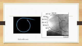 Intracardiac Dr lamiaa Allam [upl. by Dulciana162]