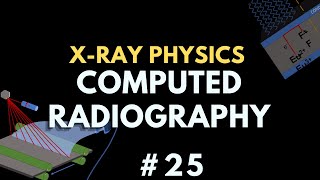 Computed Radiography Digital Radiography  Xray Physics  Radiology Physics Course 32 [upl. by Anigroeg]