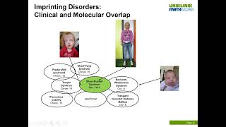 Molecular diagnostic testing of imprinting disorders and related growth disturbances [upl. by Ojimmas]