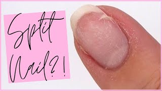 HOW TO FIX A BROKEN NAIL \\ SPLIT NAIL REPAIR TUTORIAL  THE GEL BOTTLE INC [upl. by Ralip]