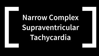 Narrow Complex Supraventricular Tachycardia [upl. by Kcirneh772]