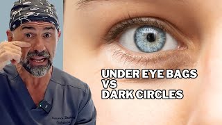 Under eye bags vs dark circles the truth explained [upl. by Nnahoj912]