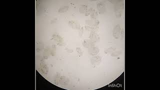 Paramecium and its conjugation process under microscope TheNatureandScience [upl. by Poock]