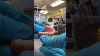 Please subscribe orthodontics dentist science shorts satisfying shortvideo [upl. by Prakash]