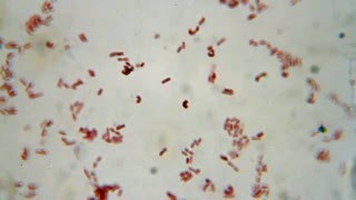 Microscope view of bacteria [upl. by Anez]