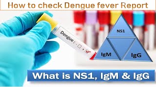 Dengue Fever Blood Tests Report Immunoglobulin Dengue NS1 AntigenIgM Positive IgG Positive [upl. by Mazur683]