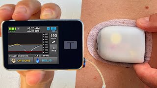 Omnipod 5 vs Tandem tslim x2  Full Test amp Review [upl. by Becca]