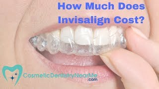 How much does Invisalign® cost [upl. by Kasey]