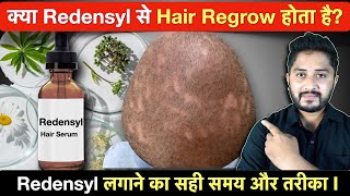 क्या Redensyl से Hair Regrow होता है Redensyl Serum for Hair Growth [upl. by Earlene63]