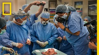 Youngest Face Transplant Recipient in US  National Geographic [upl. by Grubman]