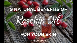 9 Natural Benefits of Rosehip Oil for Your Skin [upl. by Anidem]