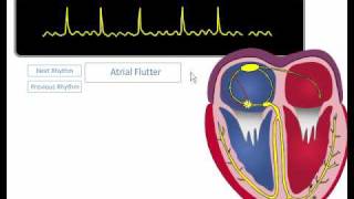 ACLS ECG Rhythm Review [upl. by Shifra]