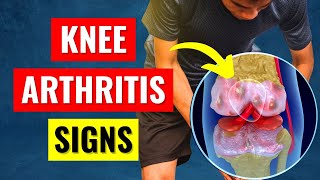 Knee Pain Arthritis Symptoms  What You Need To Know [upl. by Reggi]