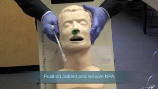 Nasotracheal Intubation [upl. by Earezed607]