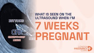 Week 7 Pregnant Ultrasound Babys Heartbeat amp Growth Shown [upl. by Eilatan]