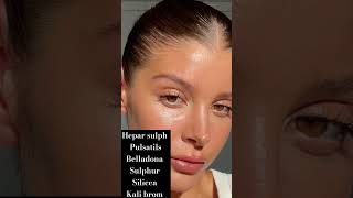 Best medicine for acne homeopathic homeopathy acne remedy cureskin skinproblems [upl. by Casia]