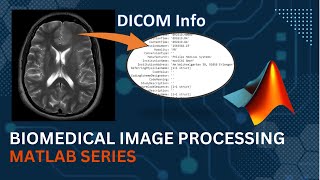 Getting Info of DICOM file  MATLAB  Medical Image Processing [upl. by Anjela]