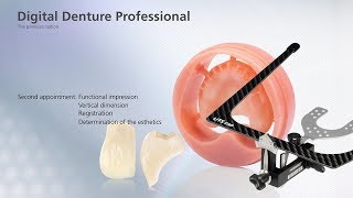 Digital Denture – second Appointment [upl. by Annmaria]