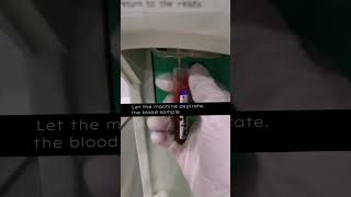 Doing complete blood count in Sysmex 3 part Hematology Analyzer cbc laboratory medtech mls cls [upl. by Schilit]