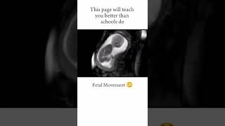 FETAL MOVEMENT😃 short youtubeshorts medical neet [upl. by Llenrad]