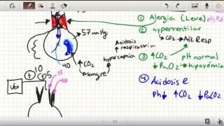 Enfermedades Pulmonares alveolares [upl. by Fredrika324]