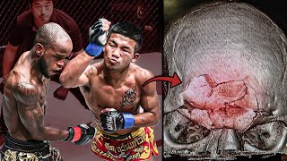 Broke His Opponents Bones The Scariest Muay Thai Fighter Ever  Rodtang Jitmuangnon [upl. by Sedicla856]