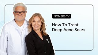 How To Treat Deep Acne Scars  What Are Ice Pick Scars amp What Causes Them [upl. by Derwin656]