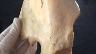 Hip bone anatomy  Part 2  The Ilium [upl. by Paske674]